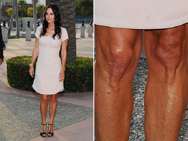 Большие щиколотки. Красивые колени. Некрасивые женские колени. Тонкие икры ног. Колени красивые и некрасивые.